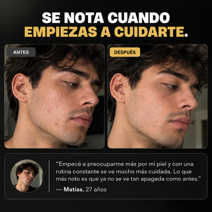 PURIFY™ | Limpiador Facial con Carbón de Bambú